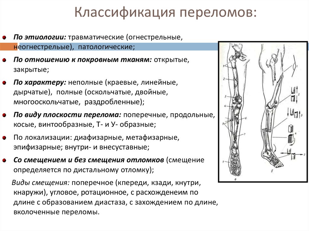 Диафизарные переломы предплечья