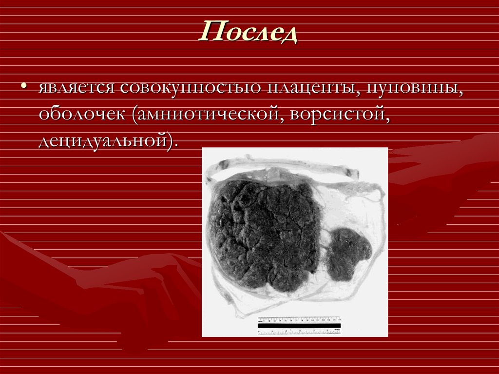 Детское место. Послед и плацента разница Акушерство. Плацента детское место.