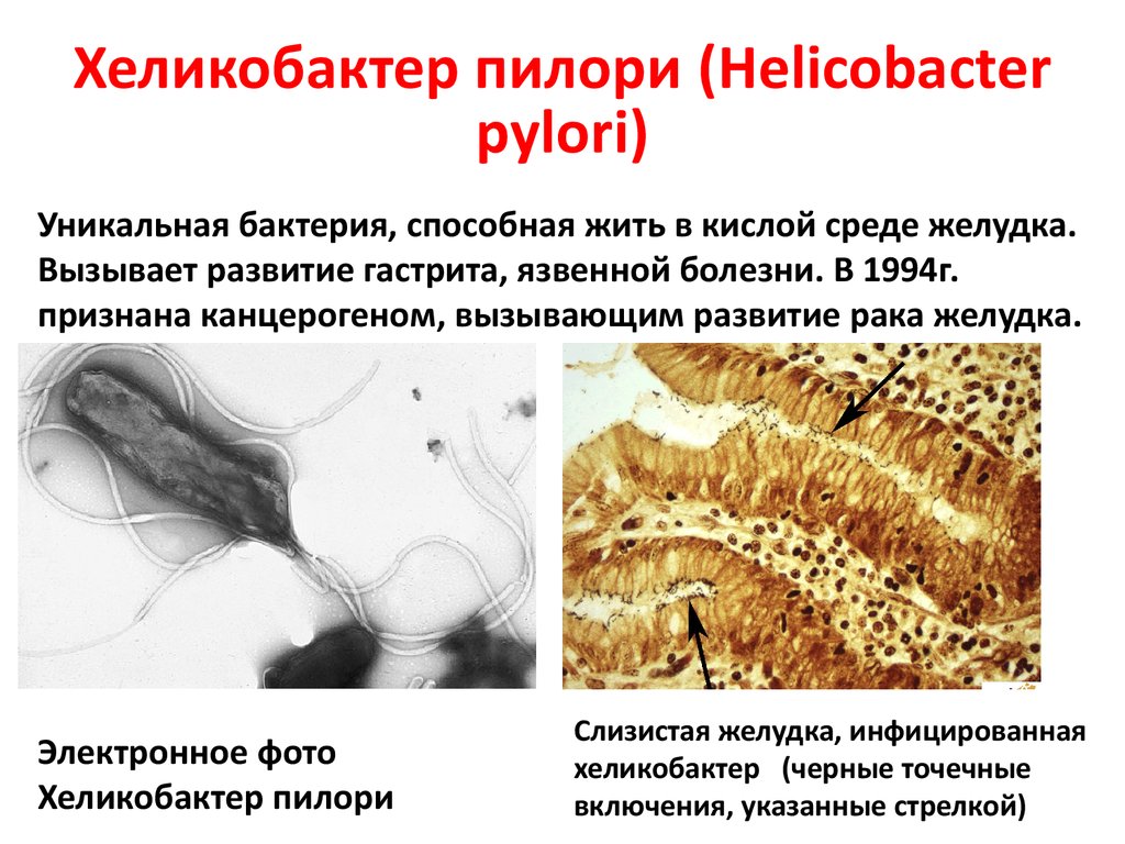 Причины заболевания хеликобактером. Препарат влияющий на хеликобактерные микроорганизм. Хеликобактер пилори в слизистой. Лекарство от микробов в желудке.