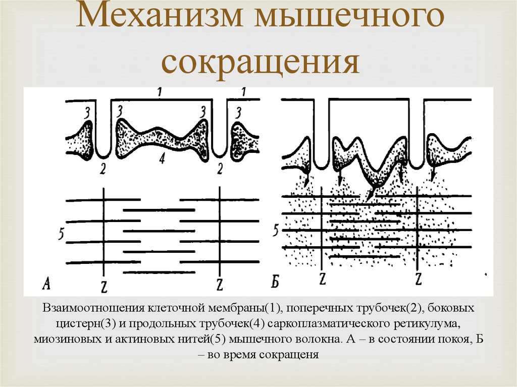 Непроизвольное сокращение мышц