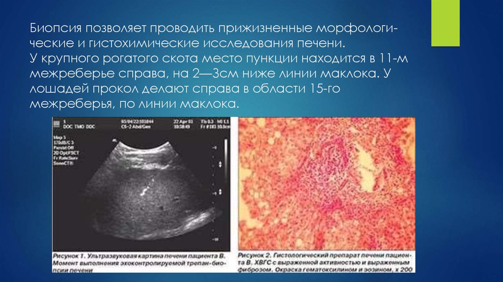 Биопсия позволяет проводить прижизненные морфологи­ческие и гистохимические исследования печени. У крупного рогатого скота