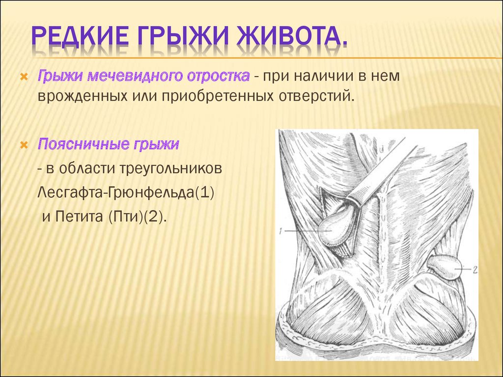 Грыжа симптомы. Треугольник Лесгафта Грюнфельда. Поясничная грыжа живота Грюнфельда-Лесгафта. Треугольник Пти и ромб Лесгафта-Грюнфельда. Грыжи живота презентация.