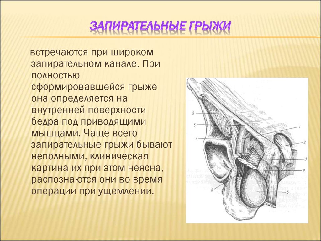 Грыжи малого таза. Запирательная грыжа топографическая анатомия. Запирательное отверстие топография. Запирательный канал анатомия. Грыжа запирательного отверстия.