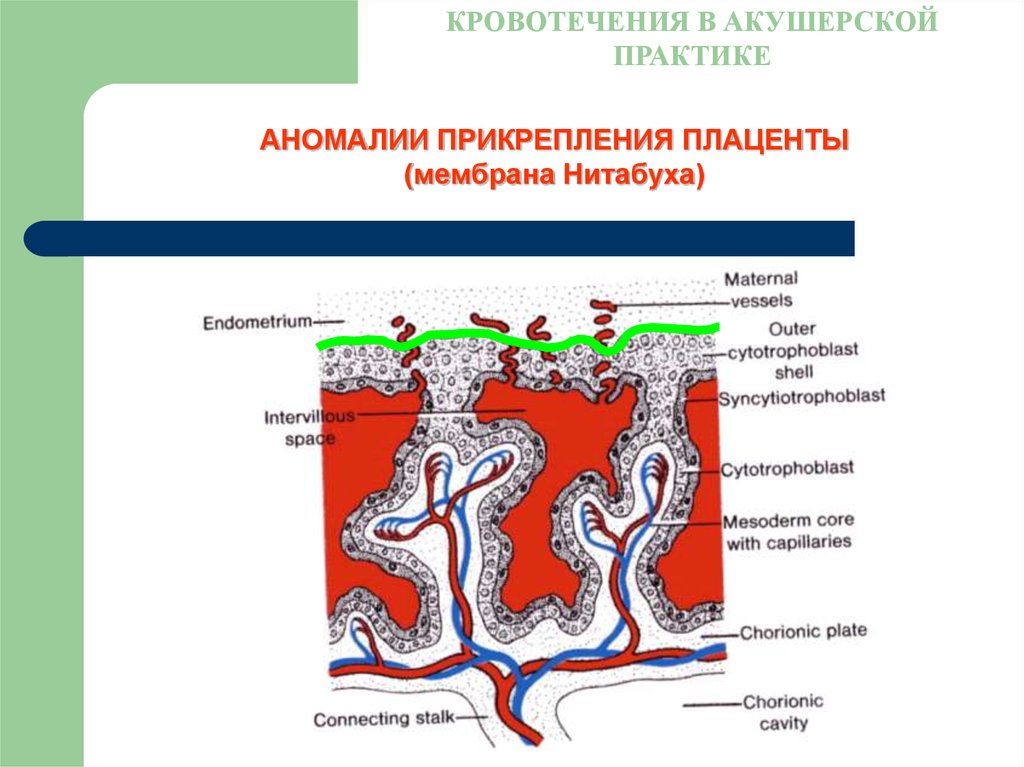 Аномалии развития плаценты презентация