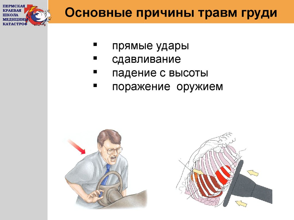 Презентация на тему сестринская помощь при травмах грудной клетки