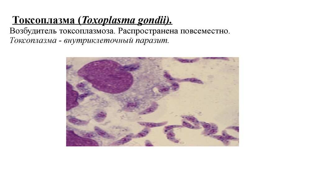 Токсоплазмоз микробиология презентация