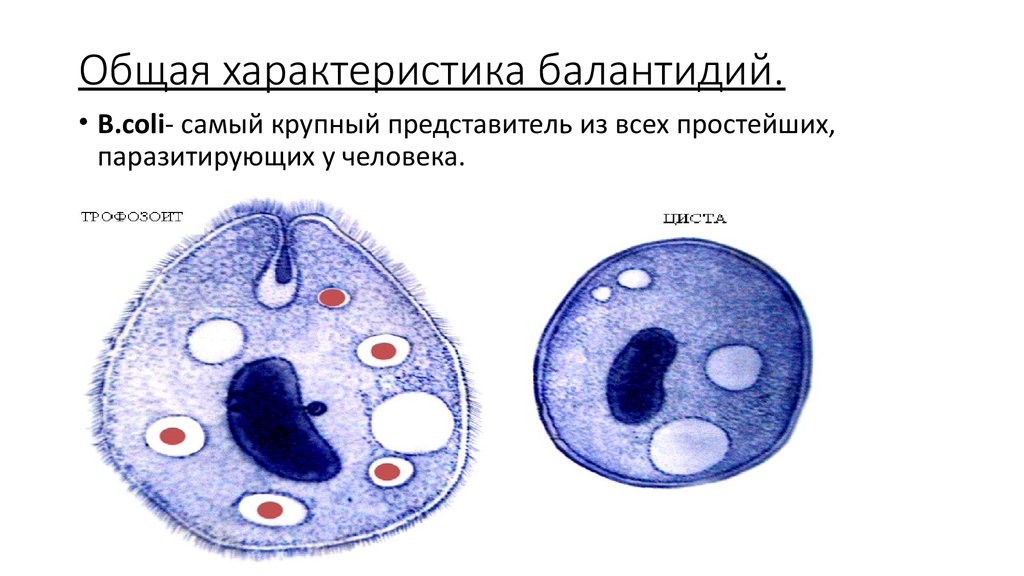 Инвазионная стадия при балантидиазе