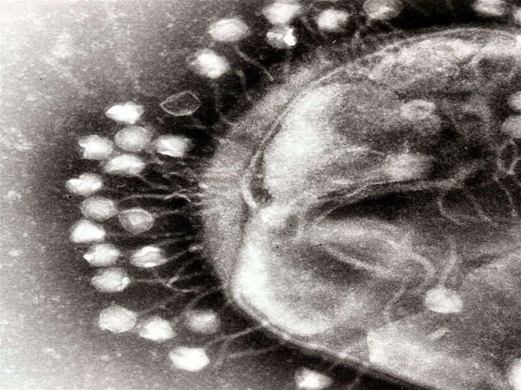 Бактериофагия. Бактериофаг микрофотография. Электронная микрофотография бактериофаг. Бактериофаг под микроскопом фото. Клетка вируса.