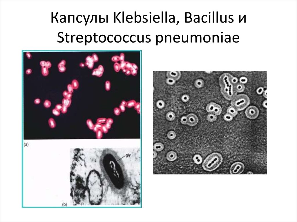 Метод бурри гинса. Streptococcus pneumoniae по Бурри ГИНСУ. Klebsiella pneumoniae окраска по Бурри ГИНСУ. Метод Бурри Гинса микробиология. Капсулы Бурри Гинса окраска.