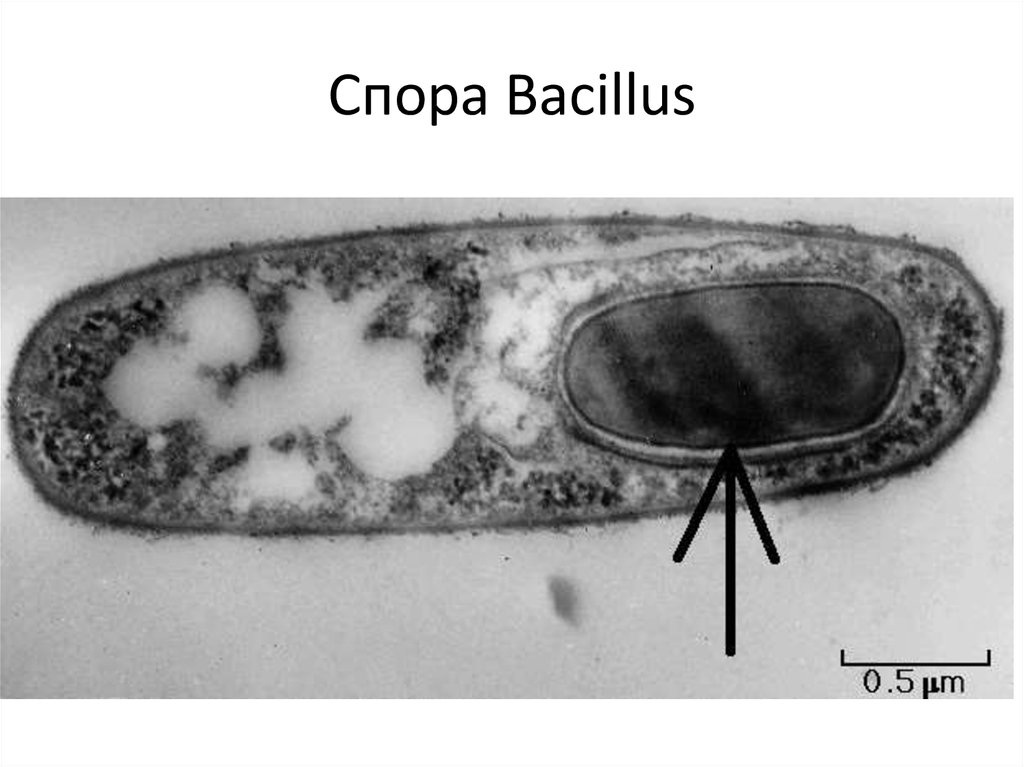 Образующие споры. Спорообразование Bacillus. Споры бактерии бациллы. Спора бактериальной клетки. Клетка бактерии споры.