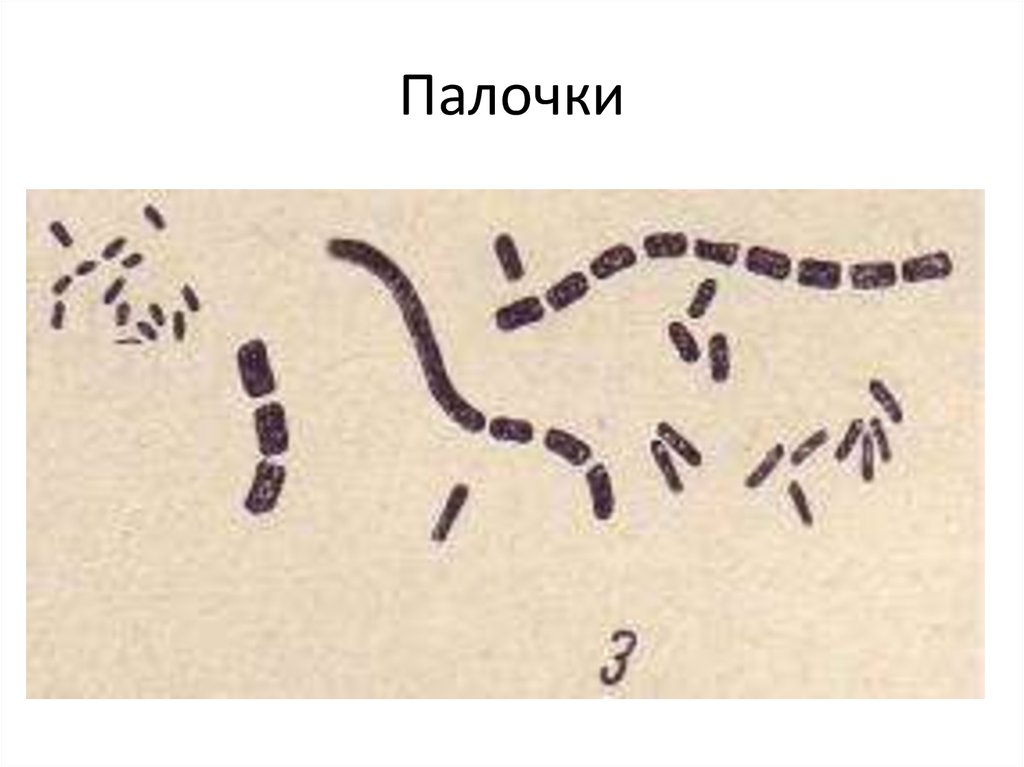 Палочковидные. Стрептобактерии палочковидные. Стрептобактерии бациллы. Диплобактерии и стрептобактерии. Палочковидные диплобактерии.