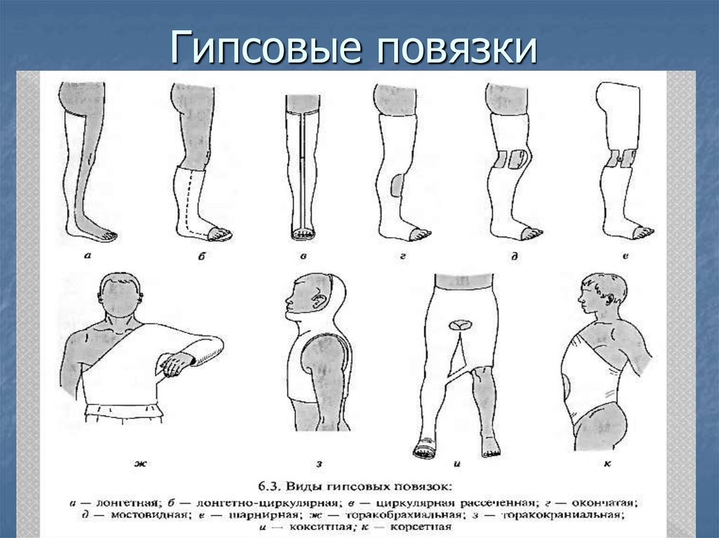 Перелом верхнего конца локтевой кости карта вызова