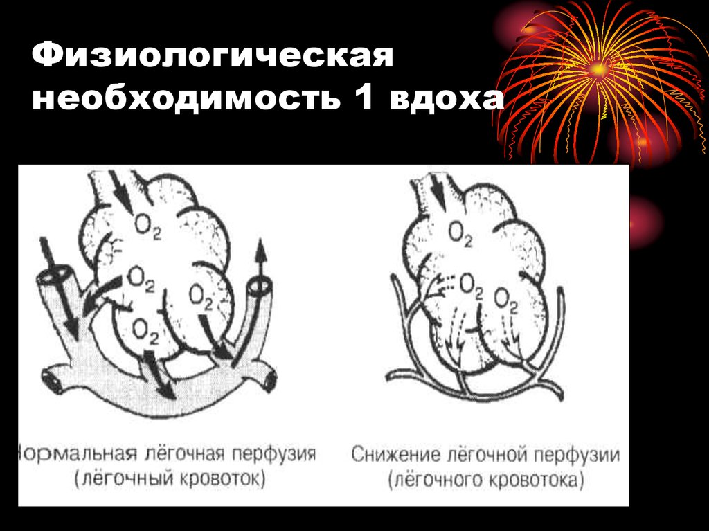 Схема первого вдоха новорожденного