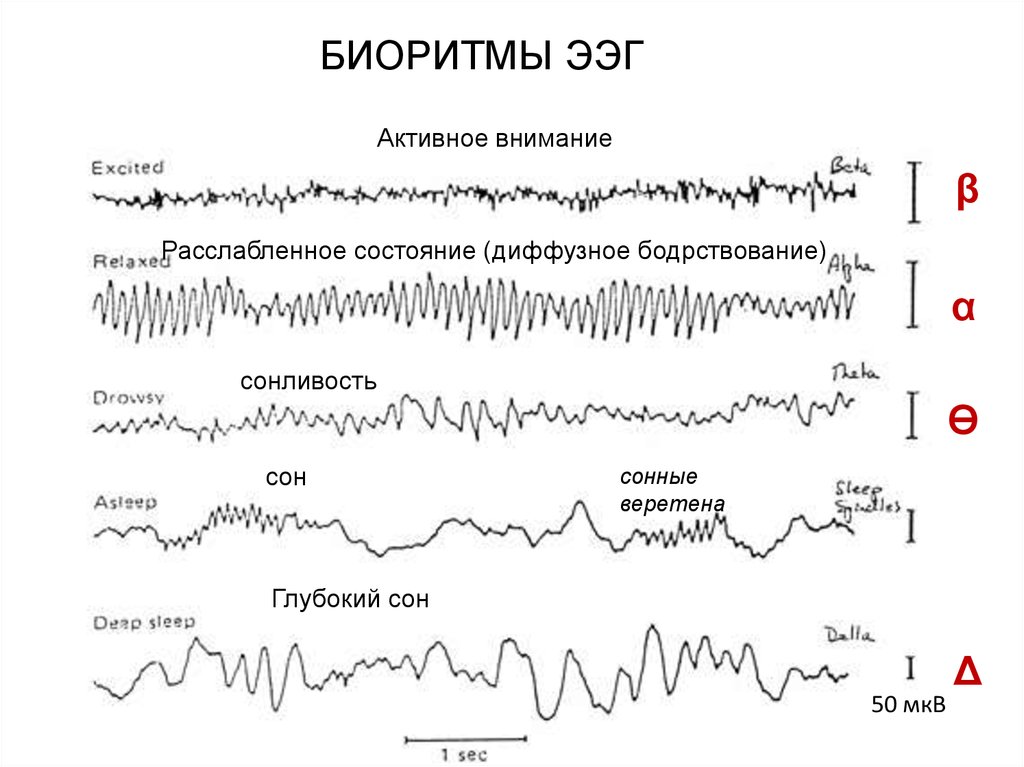 Диффузная тета активность. Расшифровка показателей электроэнцефалограммы ЭЭГ головного мозга. Эпилептиформные паттерны на ЭЭГ. Ритмы активности ЭЭГ. Патологическая активность на ЭЭГ что это.