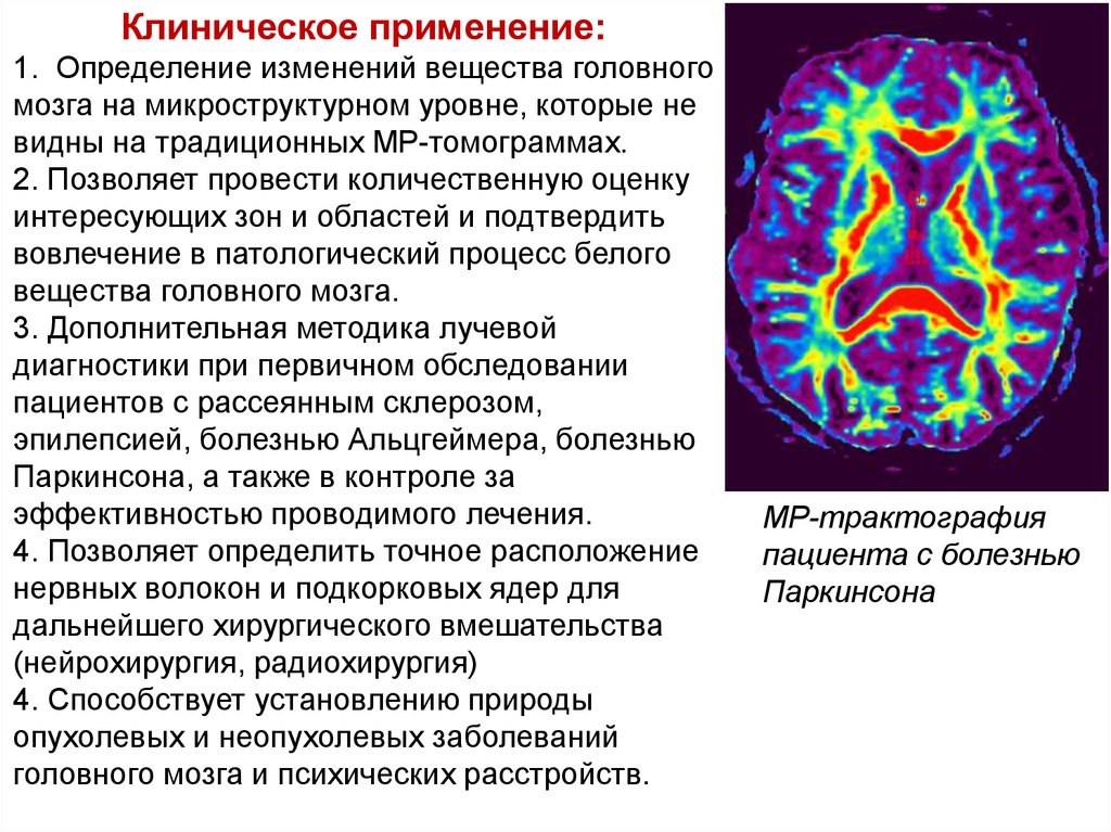 Диффузная дезорганизация головного мозга