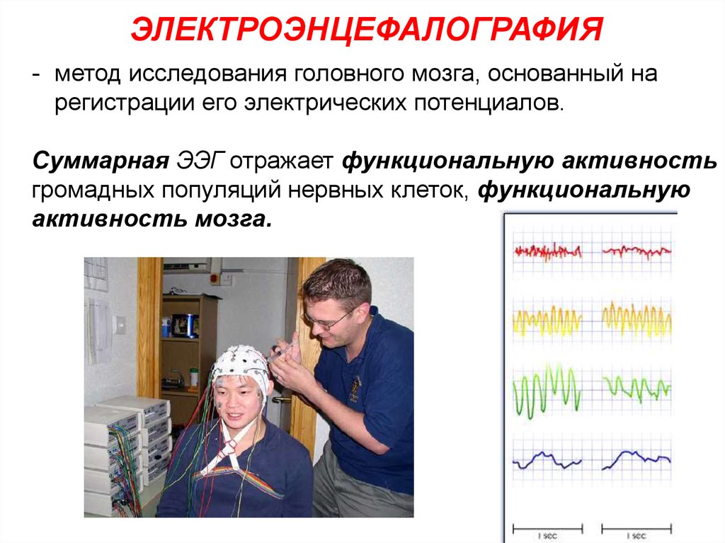 Функциональная диагностика ээг. Электроэнцефалография (ЭЭГ) метод исследования. Методы исследования электрической активности мозга. Электроэнцефалография принцип метода. Методы электроэнцефалографического исследования.