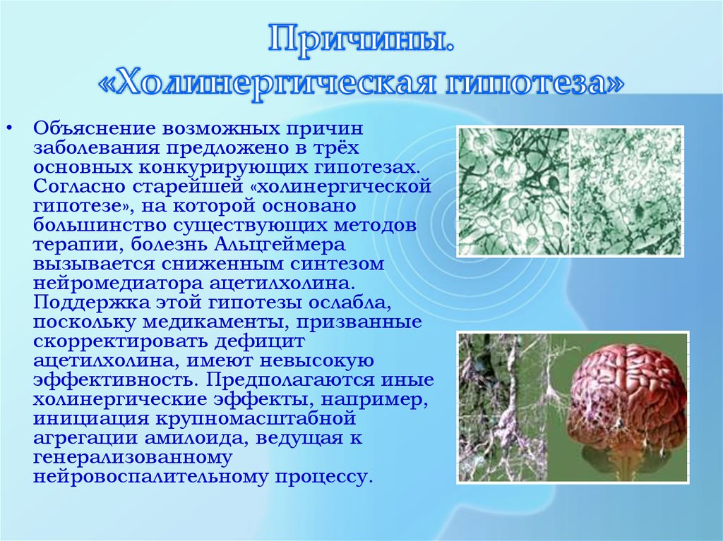 Большинство бывает. Амилоидная гипотеза. Амилоидная гипотеза гипотеза болезни Альцгеймера. Основная и конкурирующая гипотезы. 3 Основных гипотезы возникновения болезни Альцгеймера.