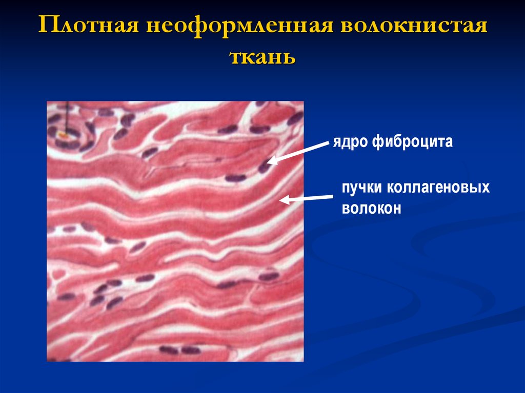 Волокнистая соединительная ткань картинки