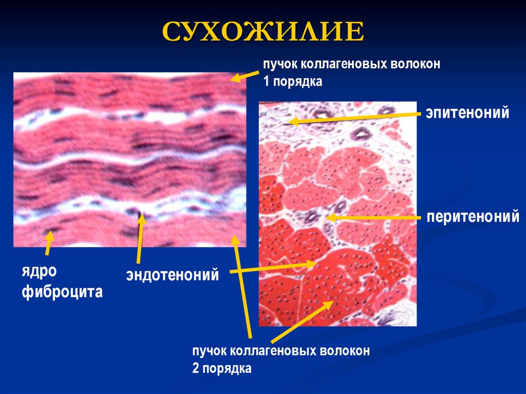 Сухожилия образованные из ткани. Плотная соединительная ткань сухожилия препарат. Плотная оформленная соединительная ткань препарат. Плотная оформленная соединительная ткань сухожилия препарат. Плотная оформленная соединительная ткань коллагеновые волокна.