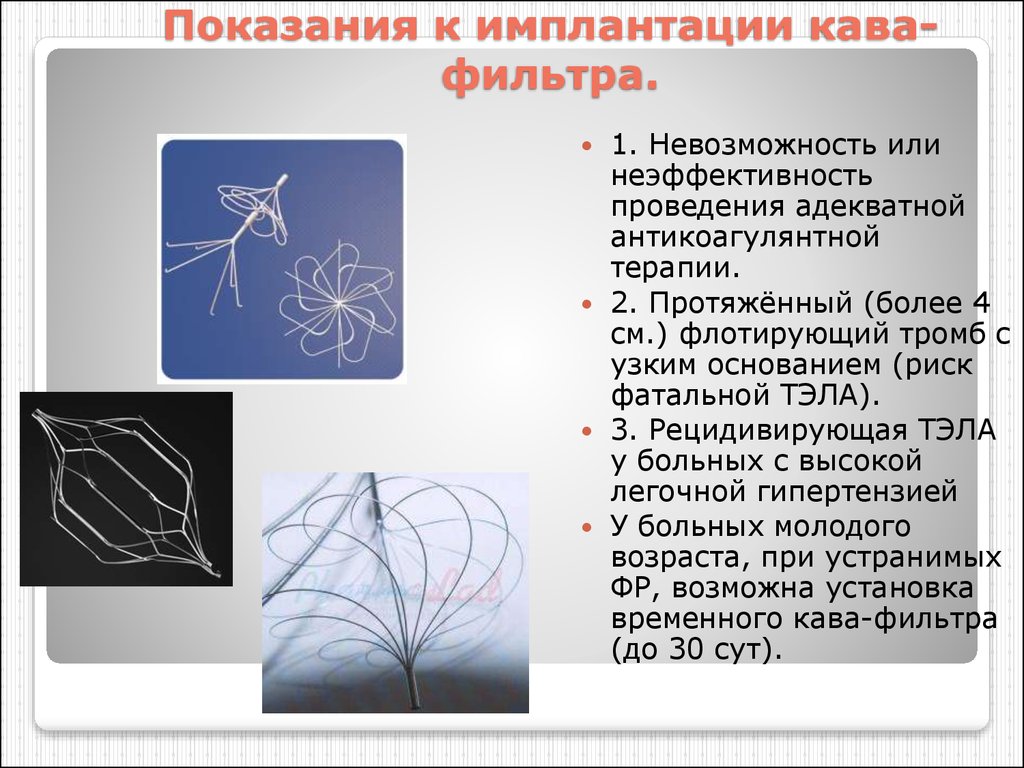 Кава фильтр при тромбозе