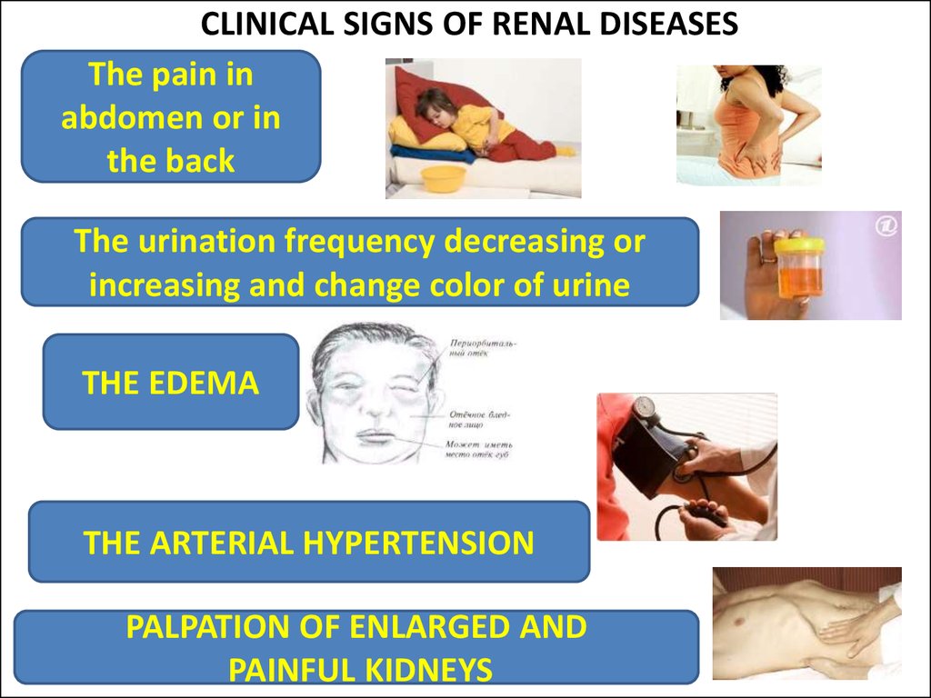 CLINICAL SIGNS OF RENAL DISEASES