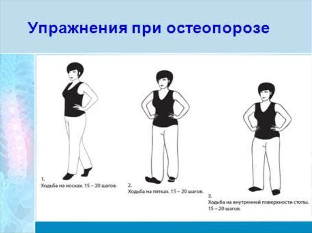 Упражнения при остеопорозе. Гимнастика при остеопорозе. Упрадненияпри остераорозе. Гимнастика приосторопорозе. Остеопороз упражнения.