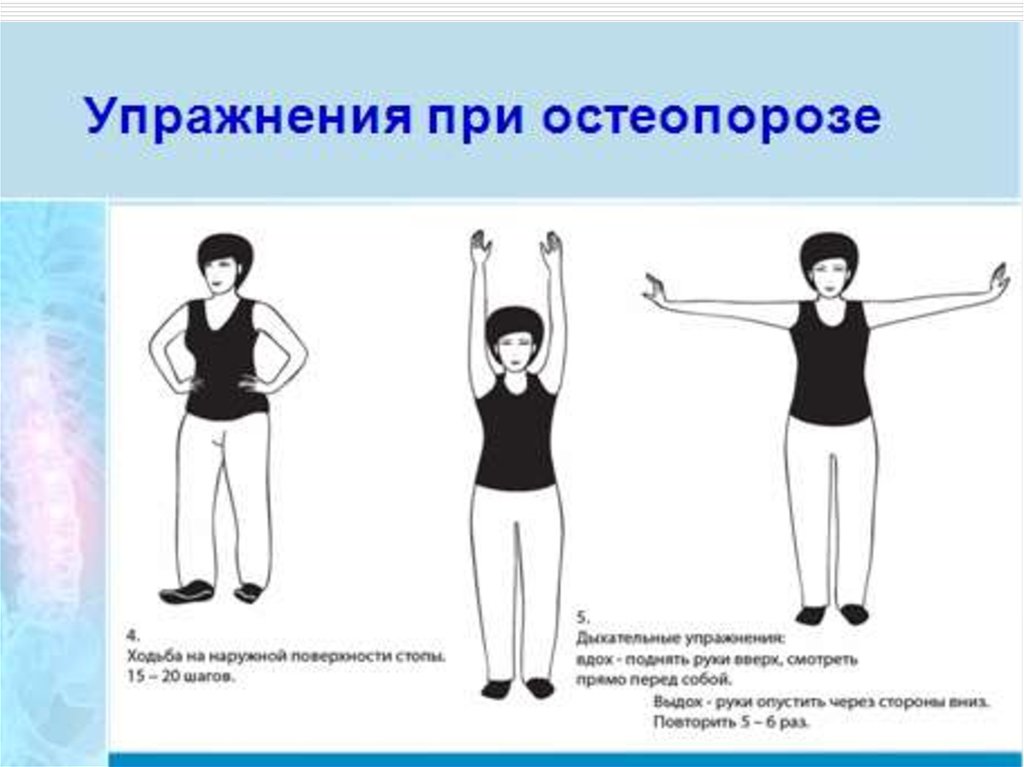 Гимнастика при остеопорозе позвоночника. Комплекс упражнений при остеопорозе в пожилом возрасте. Остеопороз позвоночника лечебная гимнастика. Комплекс упражнений при остеопорозе позвоночника. Упрадненияпри остераорозе.