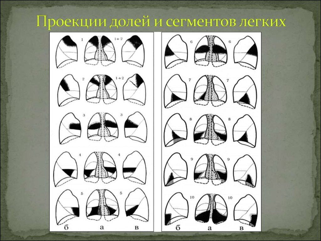 Сегменты легкого схема