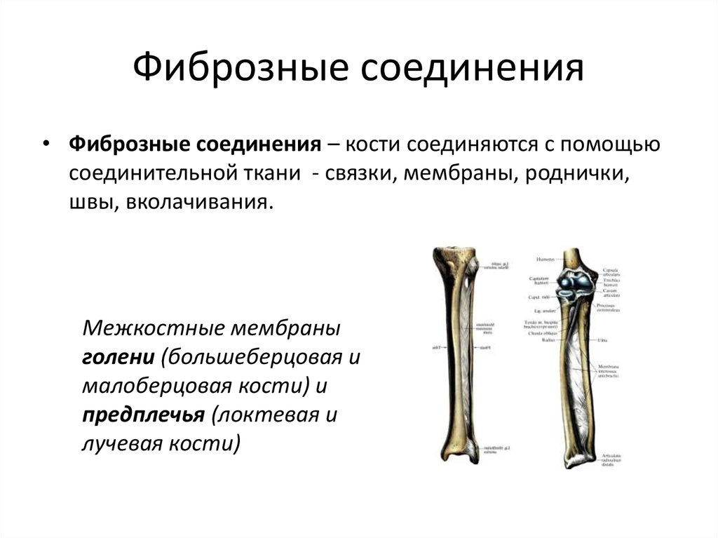 Соединение кости классификация. Соединения костей синдесмозы фиброзные. Межкостная мембрана соединяет кости. Мембрана Тип соединения костей. Непрерывные фиброзные соединения.