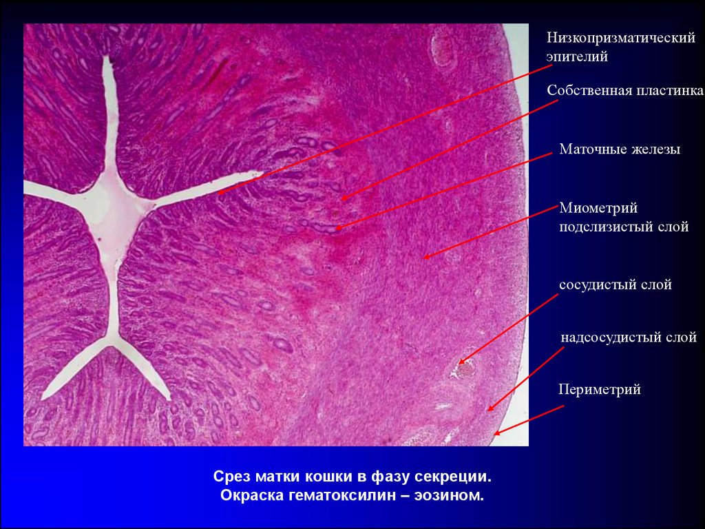 Эндометрия цервикального канала