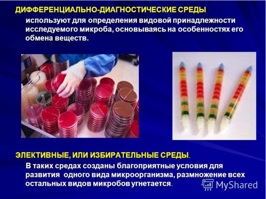 Специальные среды. Дифференциально-диагностические питательные среды микробиология. Дифференциальная диагностическая питательная среда. Элективные и дифференциально-диагностические среды. 1. Классификация питательных дифференциально-диагностических сред.