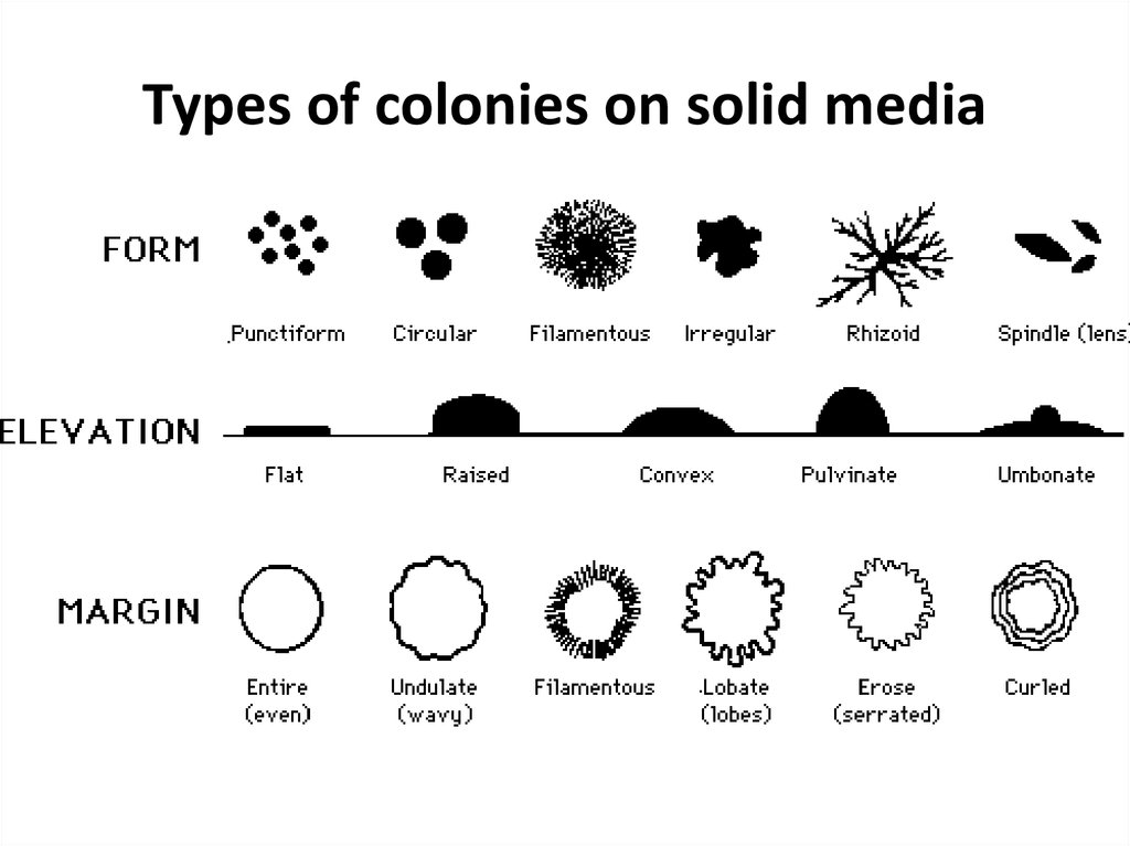 Тип s. Types of bacteria. Morphology of bacteria. Bacterial Morphology. Colony Morphology.