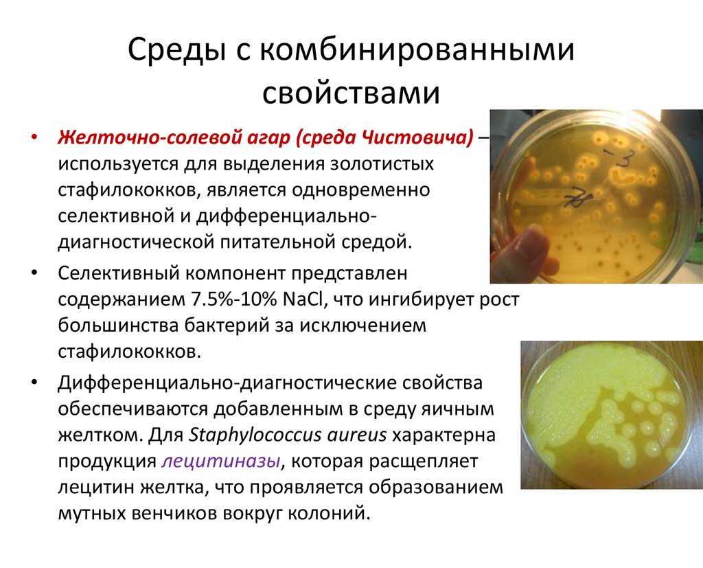 Staphylococcus aureus среда. Желточно-солевой агар (ЖСА). Среда желточно солевой агар Чистовича. Стафилококк на желточно солевом агаре. ЖСА микробиология состав.