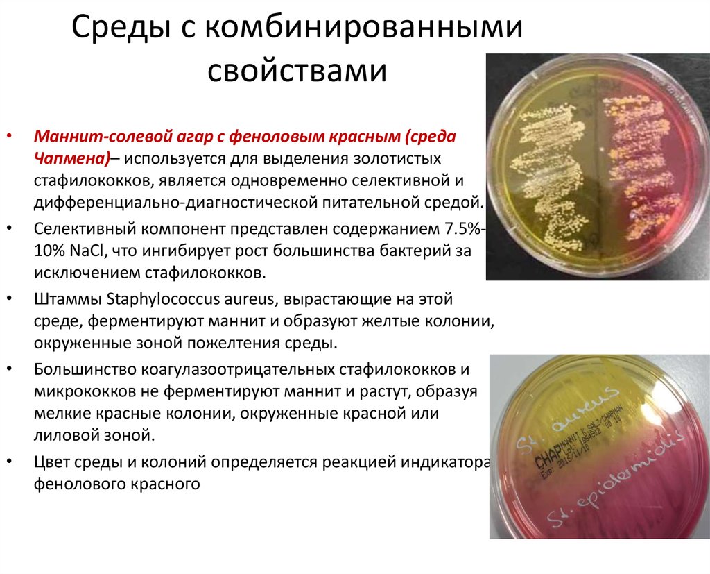 Staphylococcus aureus среда. Маннит-солевой агар для Staphylococcus. Золотистый стафилококк на маннит солевом агаре. Маннит солевой агар стафилококк. Среда для стафилококков маннит.