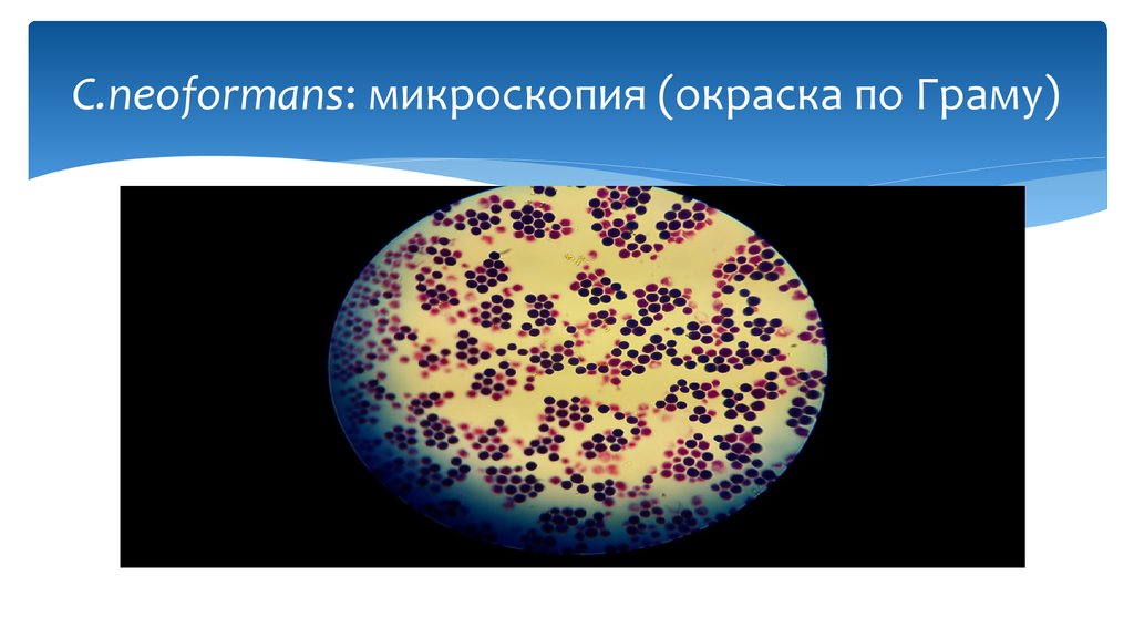 Микроскопия микробиология презентация