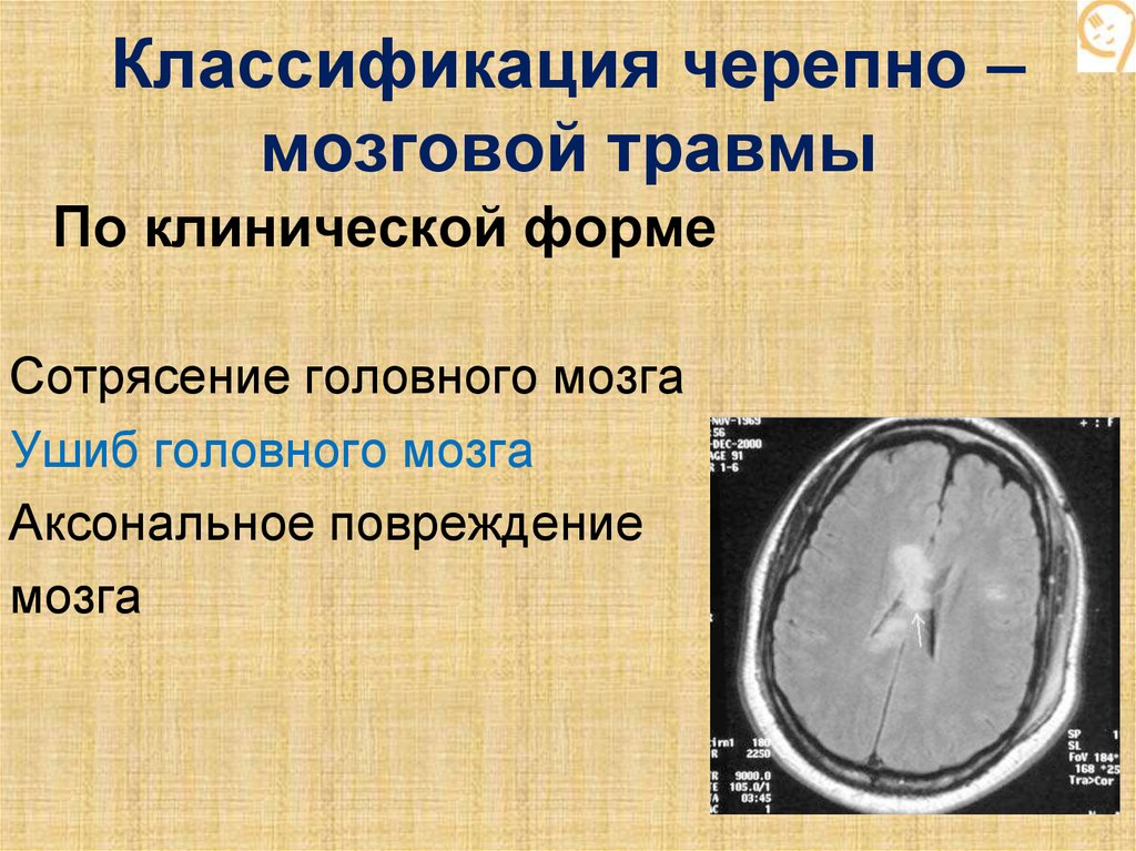 Черепно мозговая травма код. Классификация травм головного мозга неврология. Классификация закрытой черепно-мозговой травмы неврология. Черепно мозговая травма клинические симптомы. Классификация черепно-мозговых травм ЧМТ.