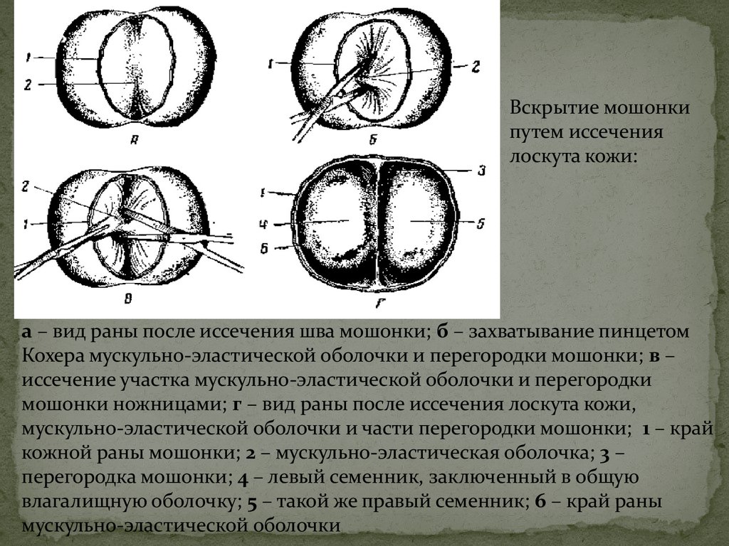 Кастрация поросят своими руками схема. Схема кастрации поросят. Эмбриональный шов на мошонке. Шов мошонки перегородка мошонки.