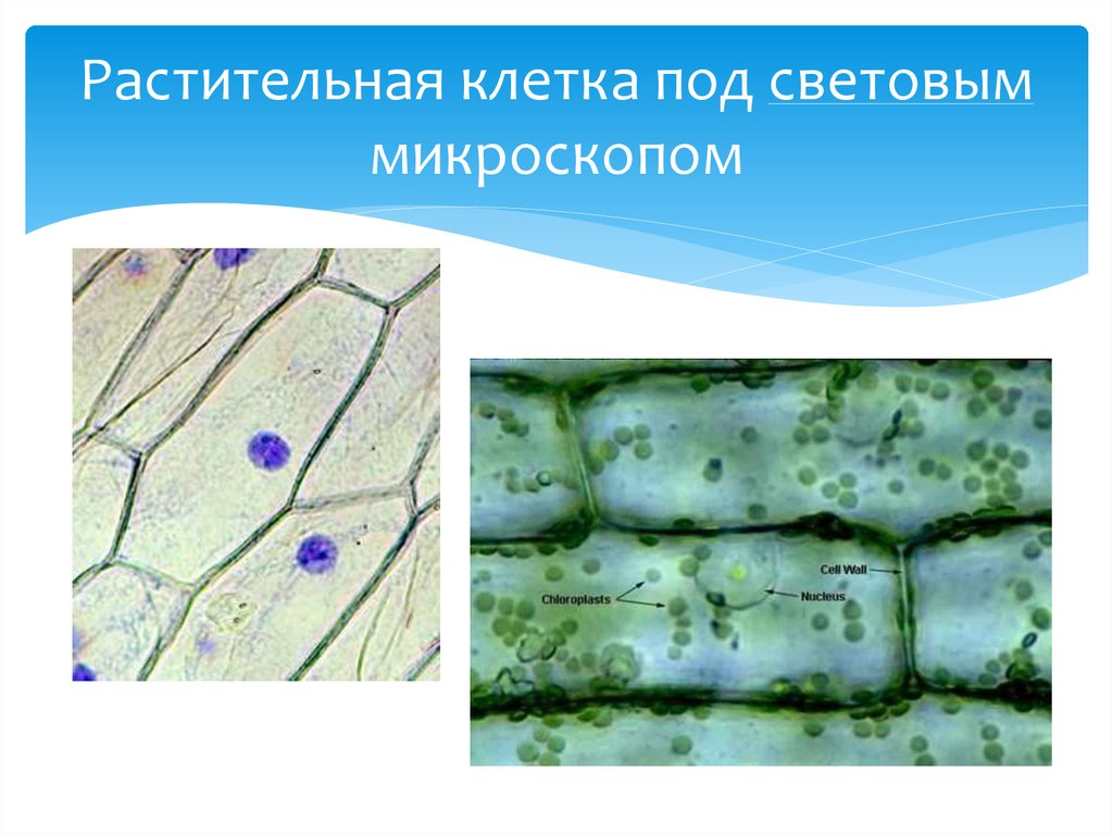 Строение под микроскопом. Клетка растения под микроскопом с подписями. Кожица листа элодеи. Строение растительной клетки под микроскопом. Клетка растения в световом микроскопе.