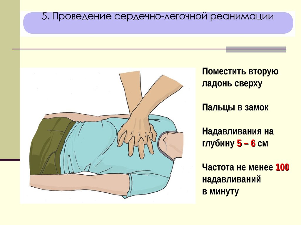 Частота надавливания при проведении компрессии. Порядок проведения при сердечно легочной реанимации. Схема проведения СЛР. Схема проведения сердечно легочной реанимации.