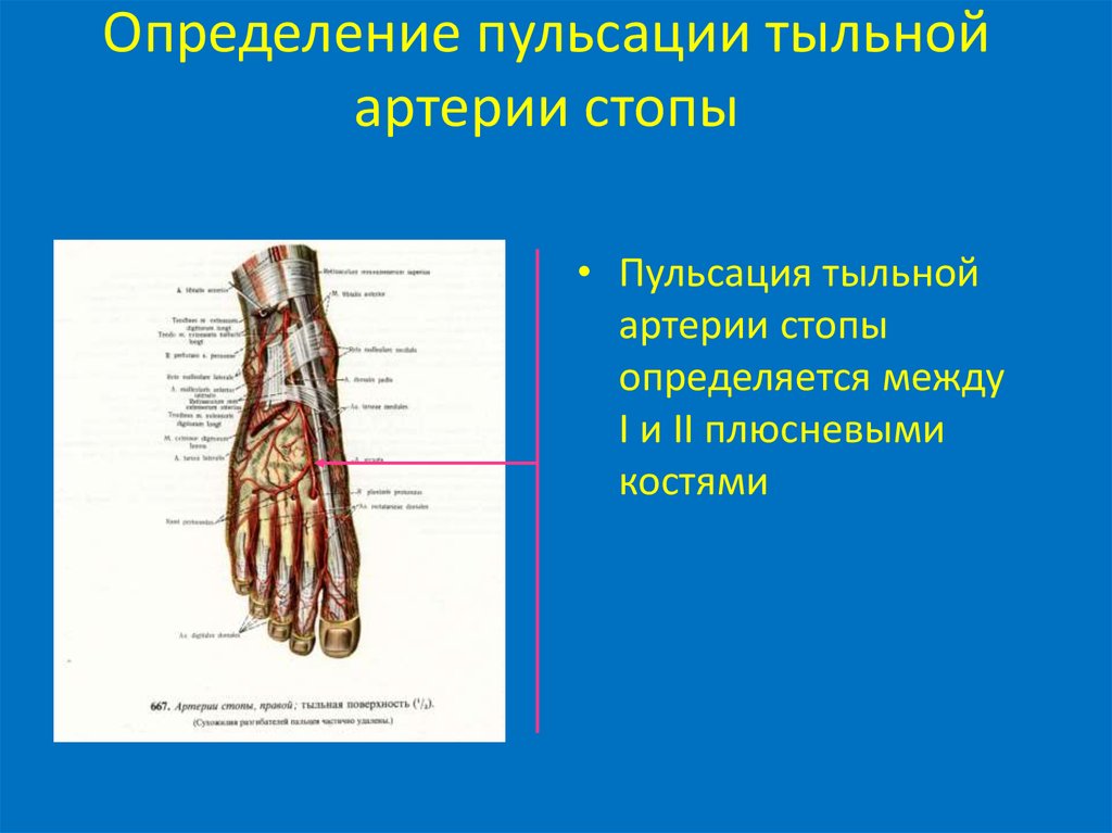 Артерии стопы. Тыльные плюсневые артерии. Методика определения пульсации артерий верхней конечности. Пульсация тыльной артерии стопы определяется.