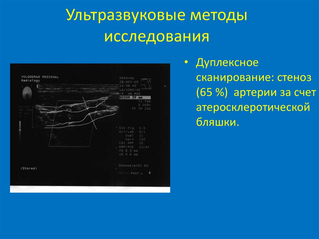 Ультразвуковые методы исследования. Методики ультразвукового исследования. Ультразвуковые исследования в медицине. Методики ультразвука.