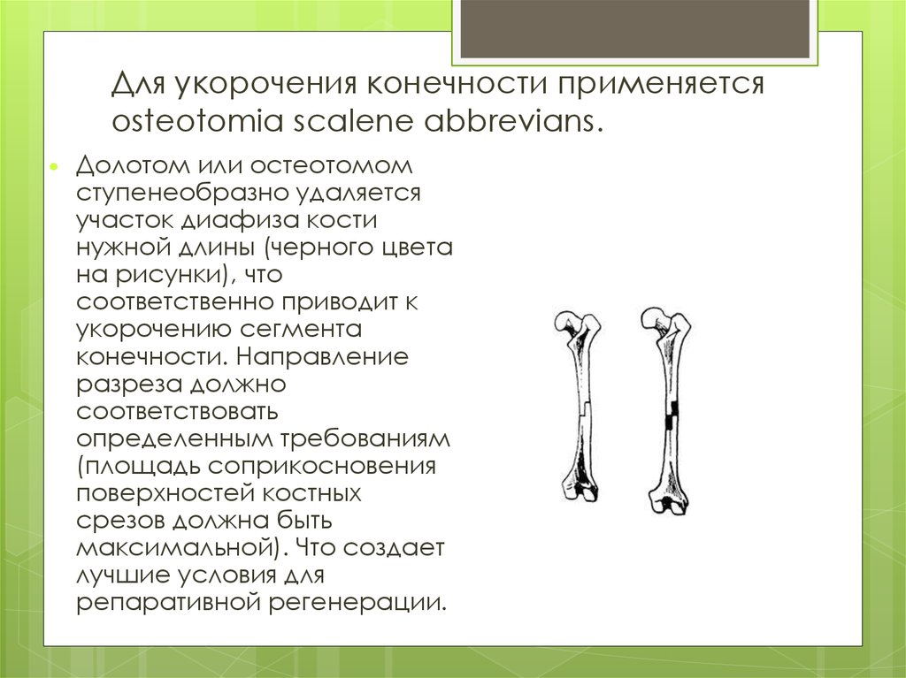 Длинные трубчатые кости конечностей