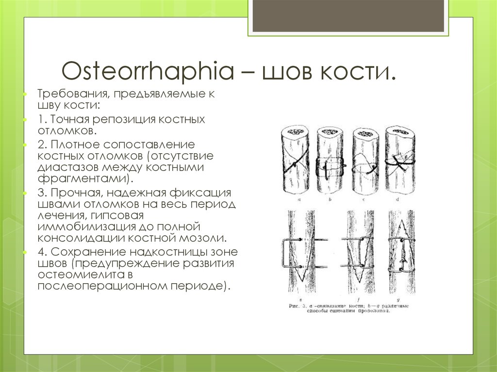 Шов кости. Костный шов характерен для костей.