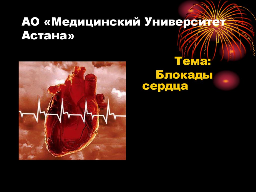 Блокада сердца опасно для жизни. Блокада сердца. Блокады сердца презентация. Блокады сердца ppt. Сердечный блок.