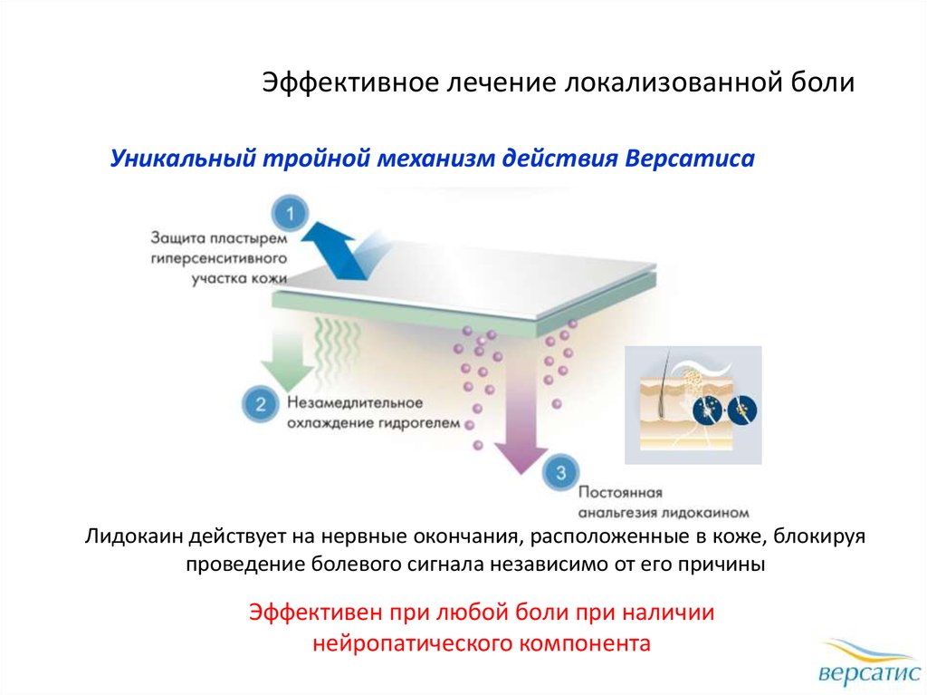 Версатис пластырь отзывы пациентов