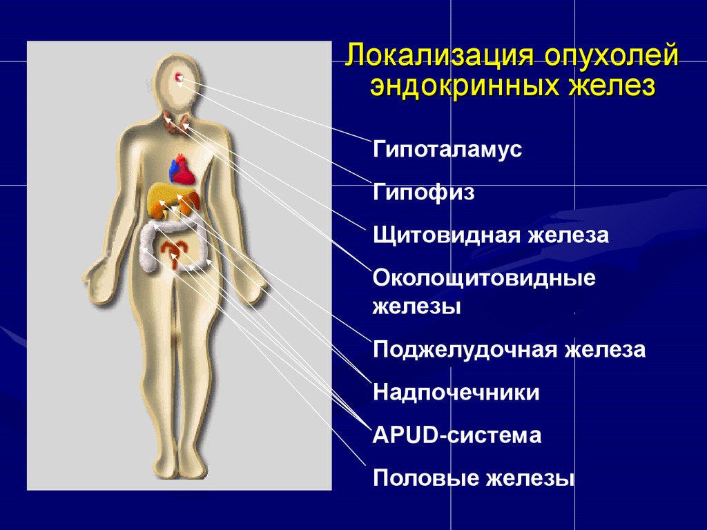 Эндокринная хирургия презентация