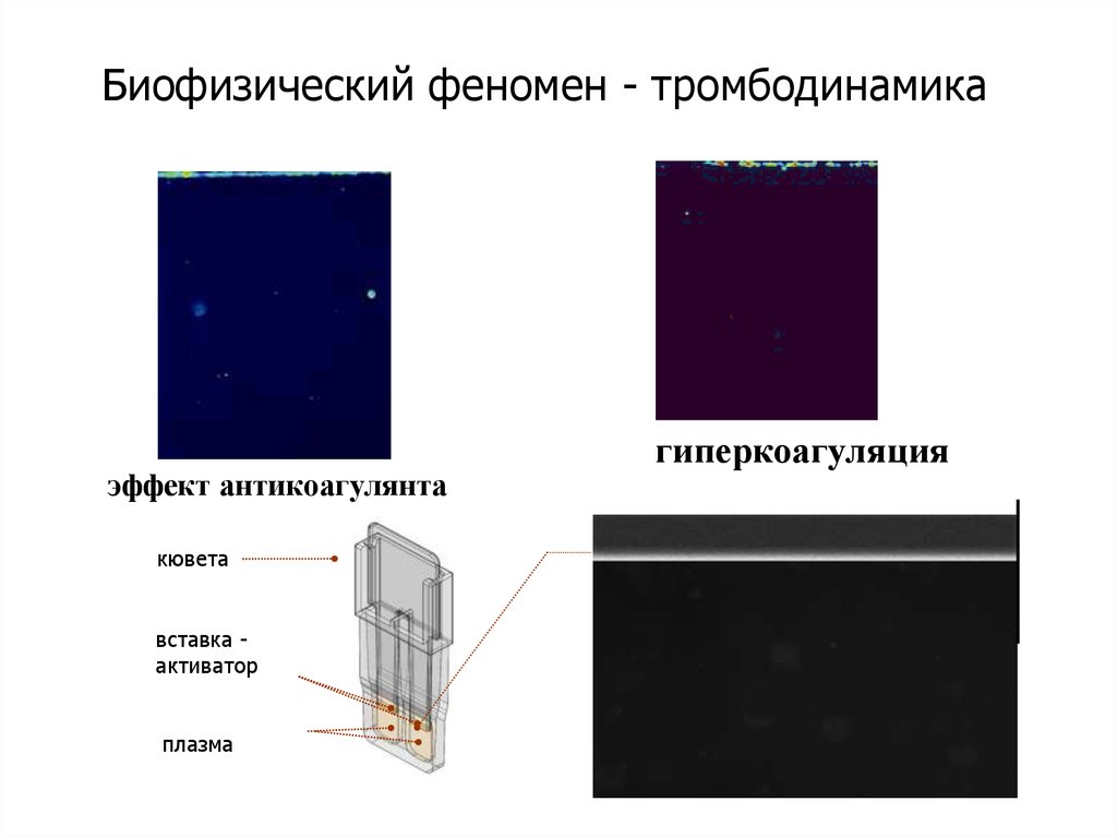 Тромбодинамика инвитро. Тромбодинамика норма. Тромбодинамика показатели. Исследование тромбодинамики. Тест Тромбодинамика.