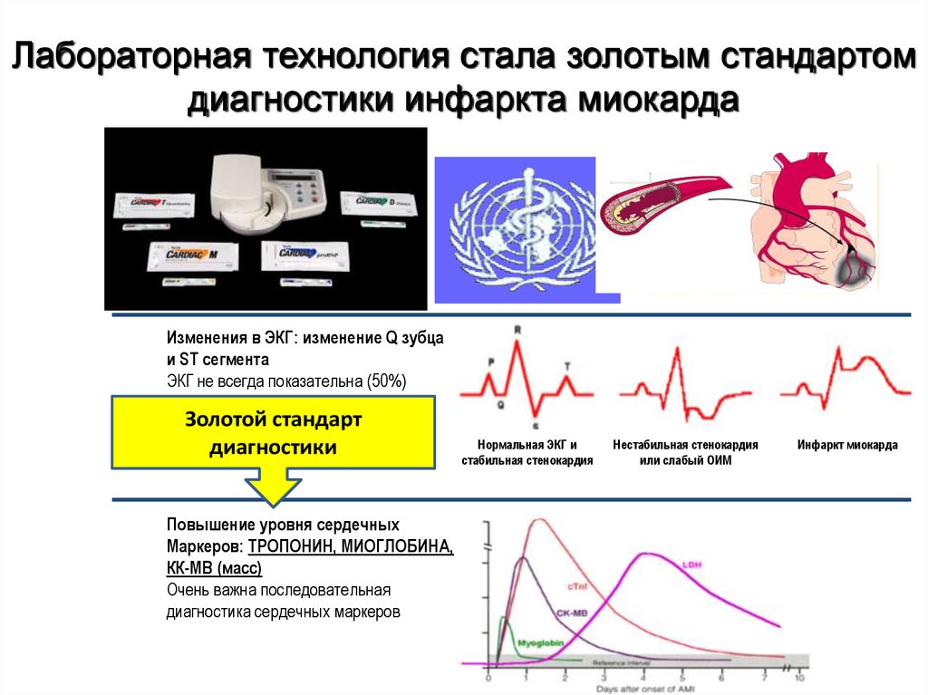 Диагностика инфаркта миокарда. Золотой стандарт диагностики стенокардии. Диагностика инфаркта миокарда стандарт. Золотой стандарт инфаркта миокарда. Кардиомаркеры инфаркта миокарда.