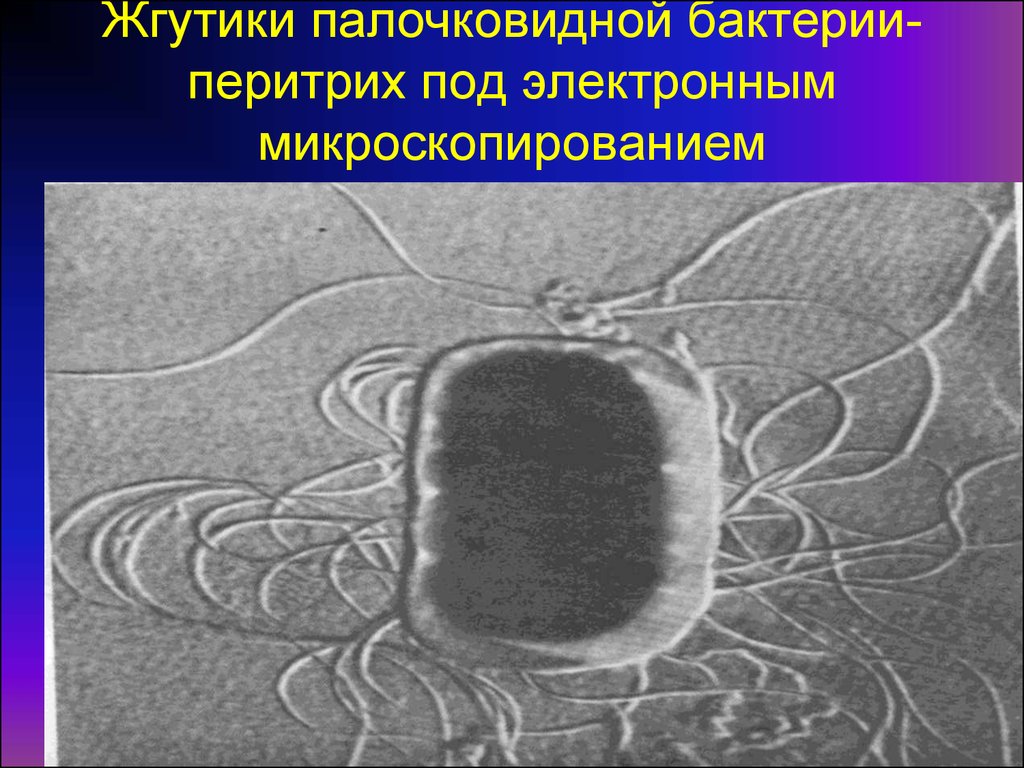 Передвижение бактерий. Жгутик в электронном микроскопе. Жгутик бактерии электронный микроскоп. Перитрихи это бактерии. Палочковидные бактерии с жгутиками.