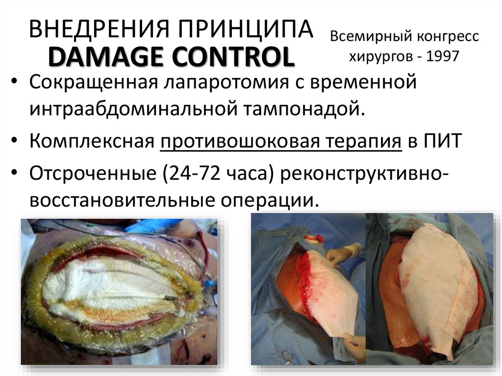 Всемирный конгресс хирургов - 1997